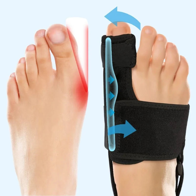 Healthway Bunion Brace (VIP)